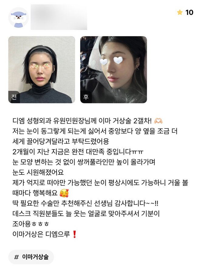 이마거상 후기."눈모양이 변하지 않고 라인이 높아져 시원해보여요!" 관련 이미지 1