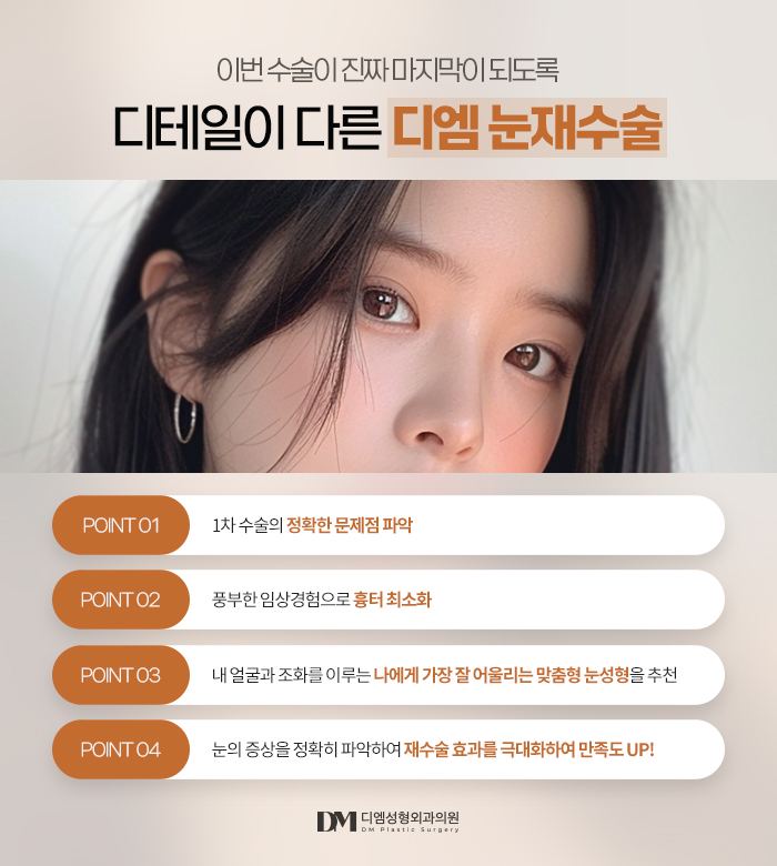 눈재수술, 쌍꺼풀이 풀려 비대칭 눈매가 되었다면? 관련 이미지 11