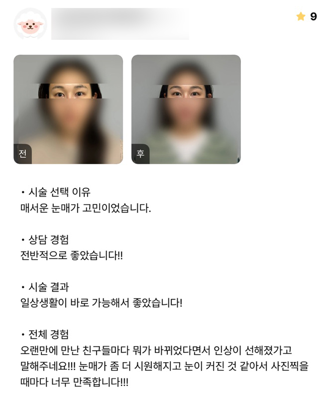 디엠 빵트임 수술후기, &ldquo;사진 찍을 때마다 너무 만족합니다!&rdquo; 관련 이미지 1