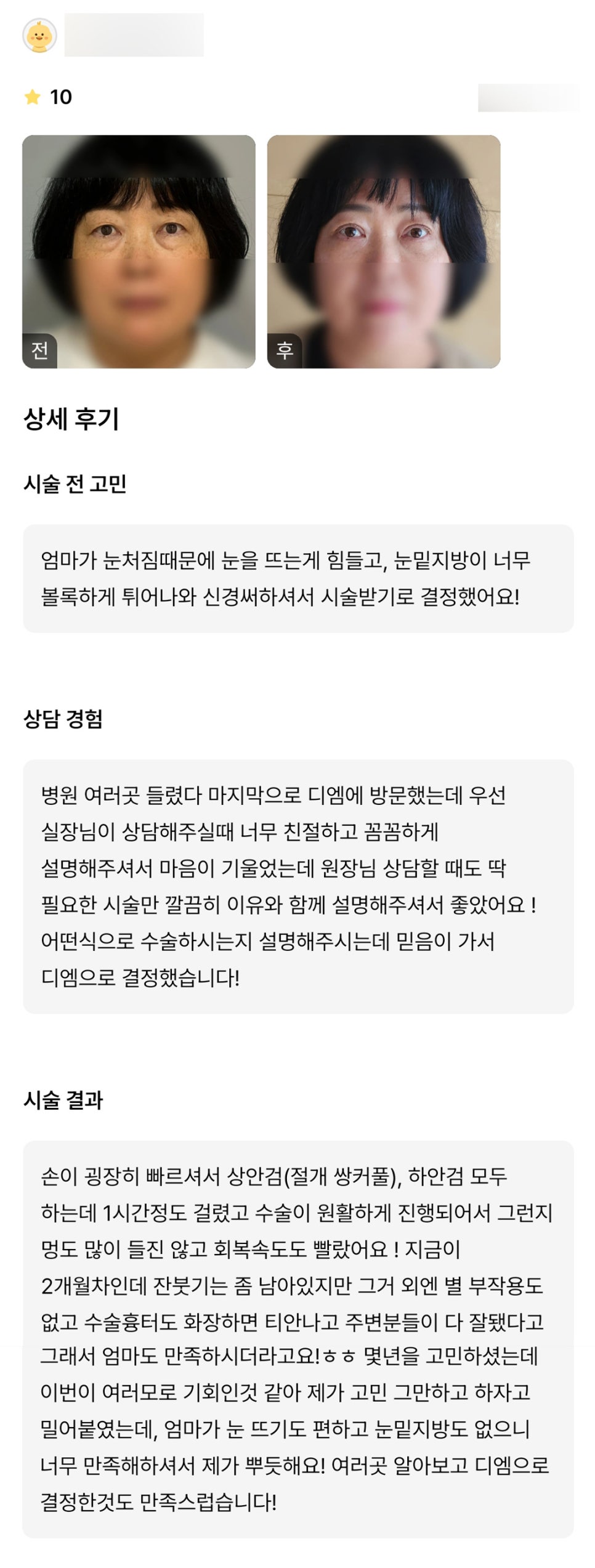 중년 눈성형 후기."엄마가 너무 만족해하셔서 제가 다 뿌듯해요!" 관련 이미지 1