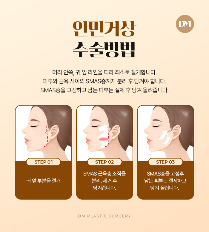 안면거상, 탄력을 잃은 피부가 고민이라면 관련 이미지 9