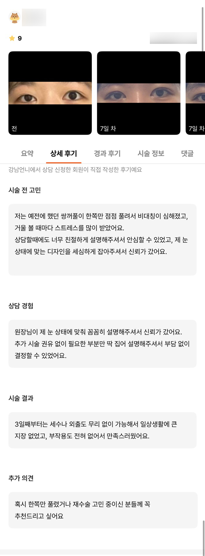 눈재수술 후기."일상생활에 큰 지장 없었고, 부작용도 전혀 없어서 만족스러웠어요" 관련 이미지 1
