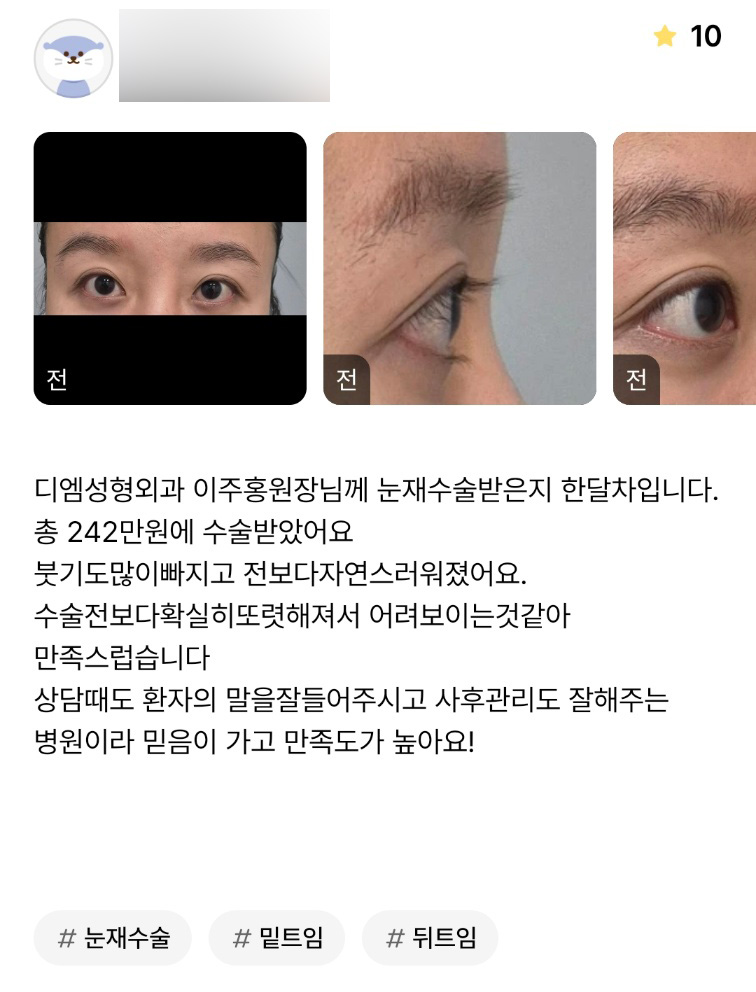 눈성형 후기."확실히 또렷하고 어려보이는 것 같아 만족스러워요!" 관련 이미지 1