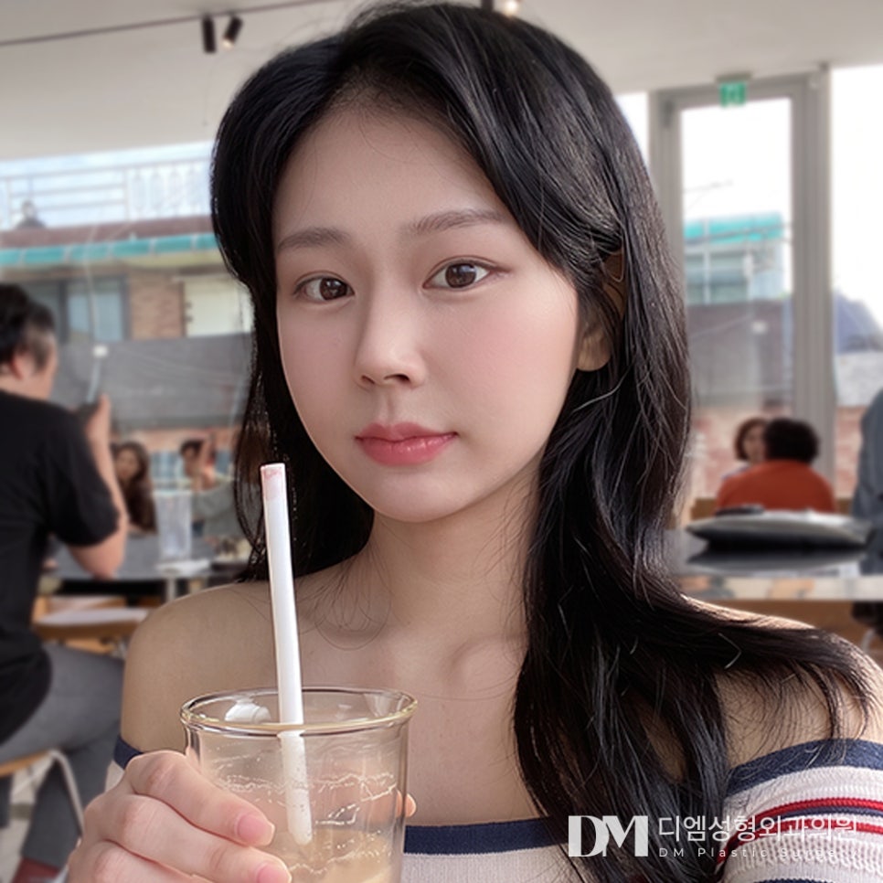 얼굴지방이식, 많이 넣을수록 예뻐질까요? 관련 이미지 1