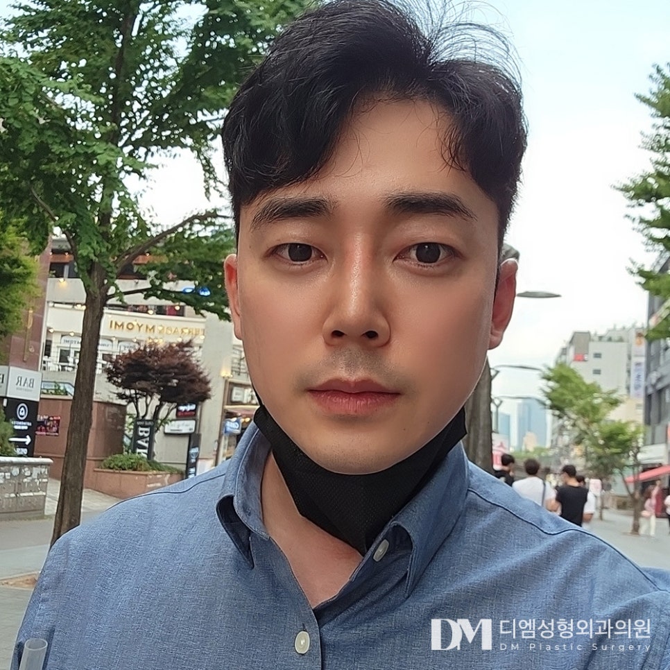 눈매교정, 피곤해보이는 인상 탈출하기 관련 이미지 15