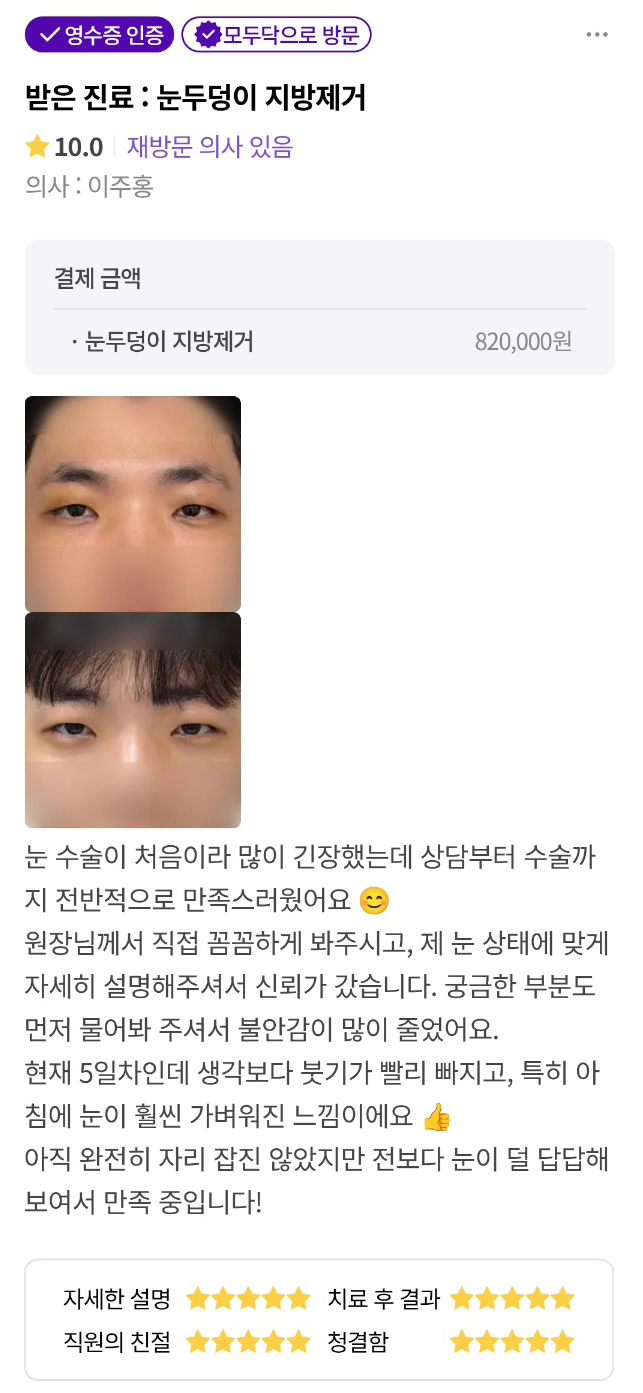 디엠 눈두덩이 지방제거 수술후기, &ldquo;전보다 눈이 덜 답답해 보여서 만족합니다!&rdquo; 관련 이미지 1