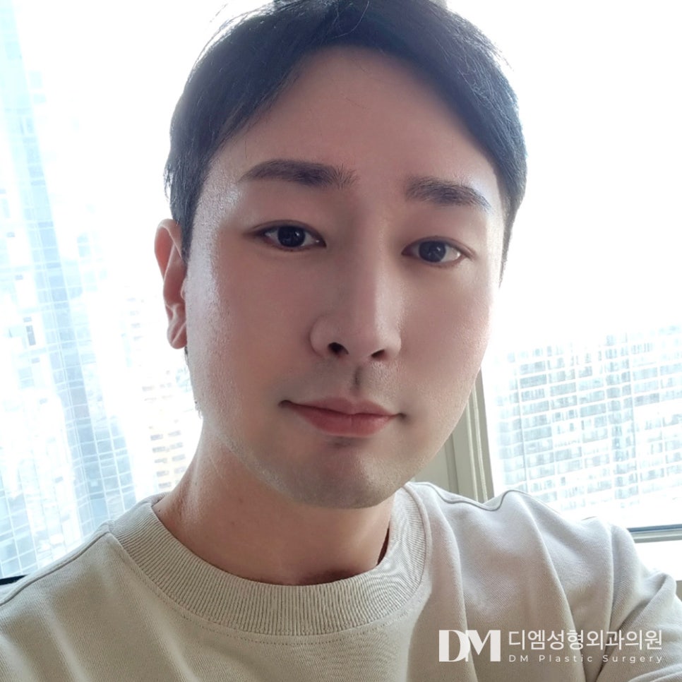 입체감 없는 낮은코가 고민이라면 관련 이미지 11