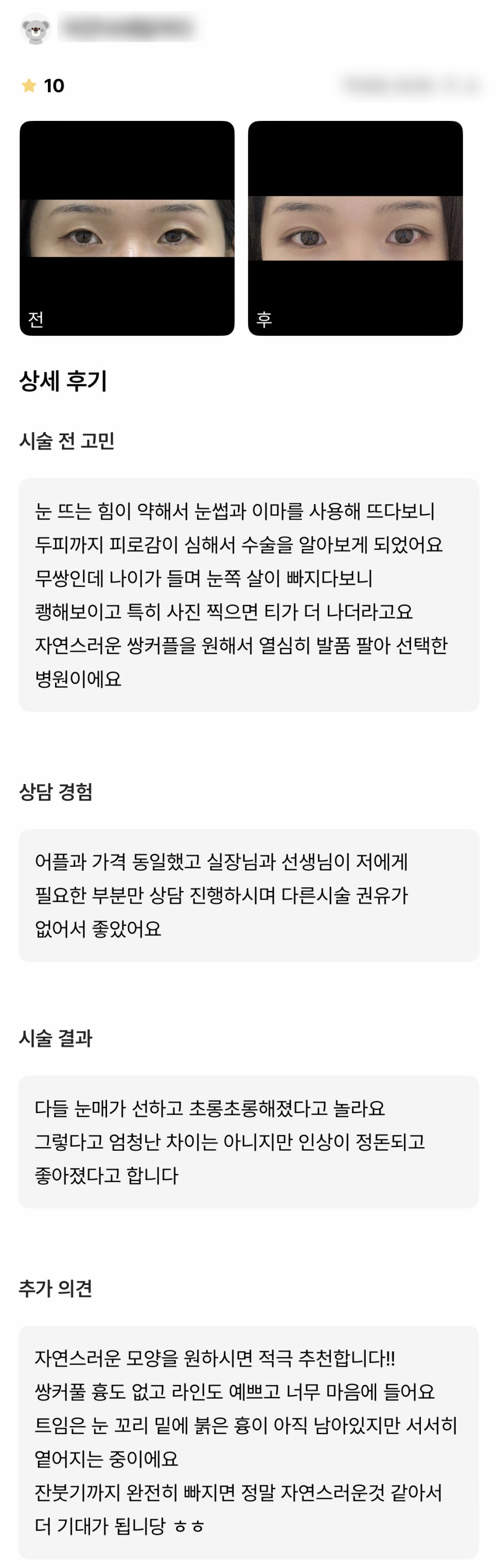 DM Eye Contouring/Outer and Lower Corner Widening Review, “They Said My Appearance Looks More Refined and Better After Surgery!” image 1