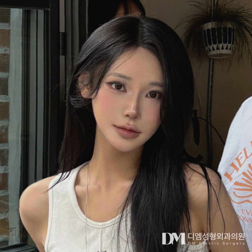 뒤밑트임, 흉터없이 순한 눈매로 관련 이미지 1