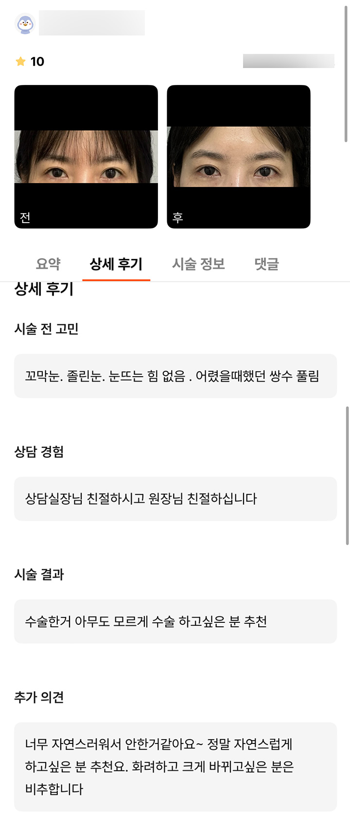 눈재수술 후기."정말 자연스럽게 하고싶은 분께 추천드려요!" 관련 이미지 1