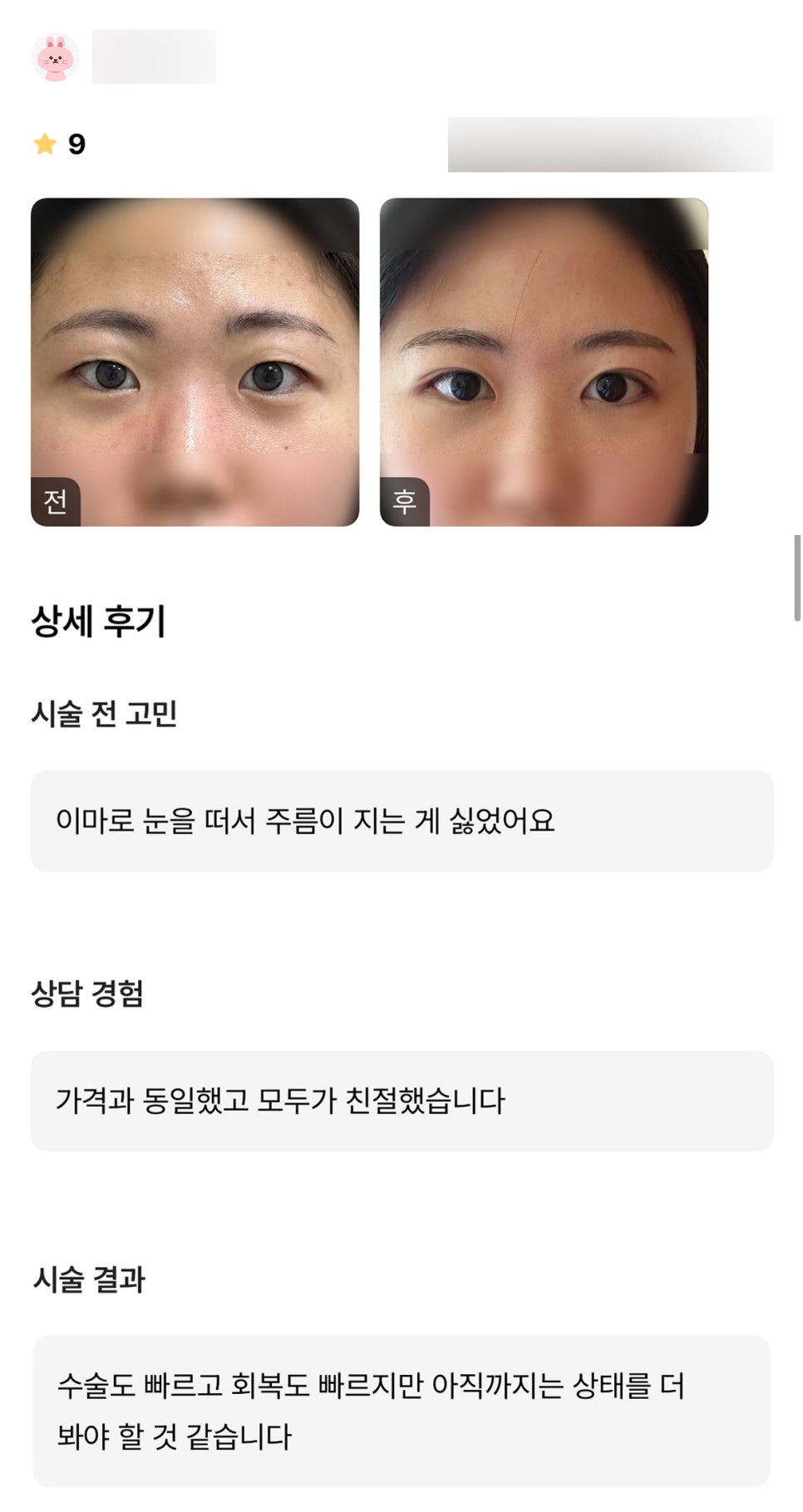 Blepharoplasty Review. "Everyone was kind, and I’m glad the recovery was fast!" image 1