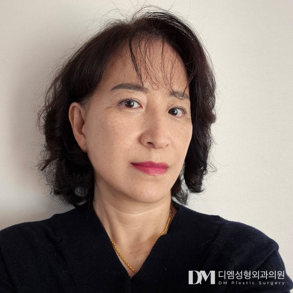 안면거상, 다시 젊었던 나로 ! 관련 이미지 16