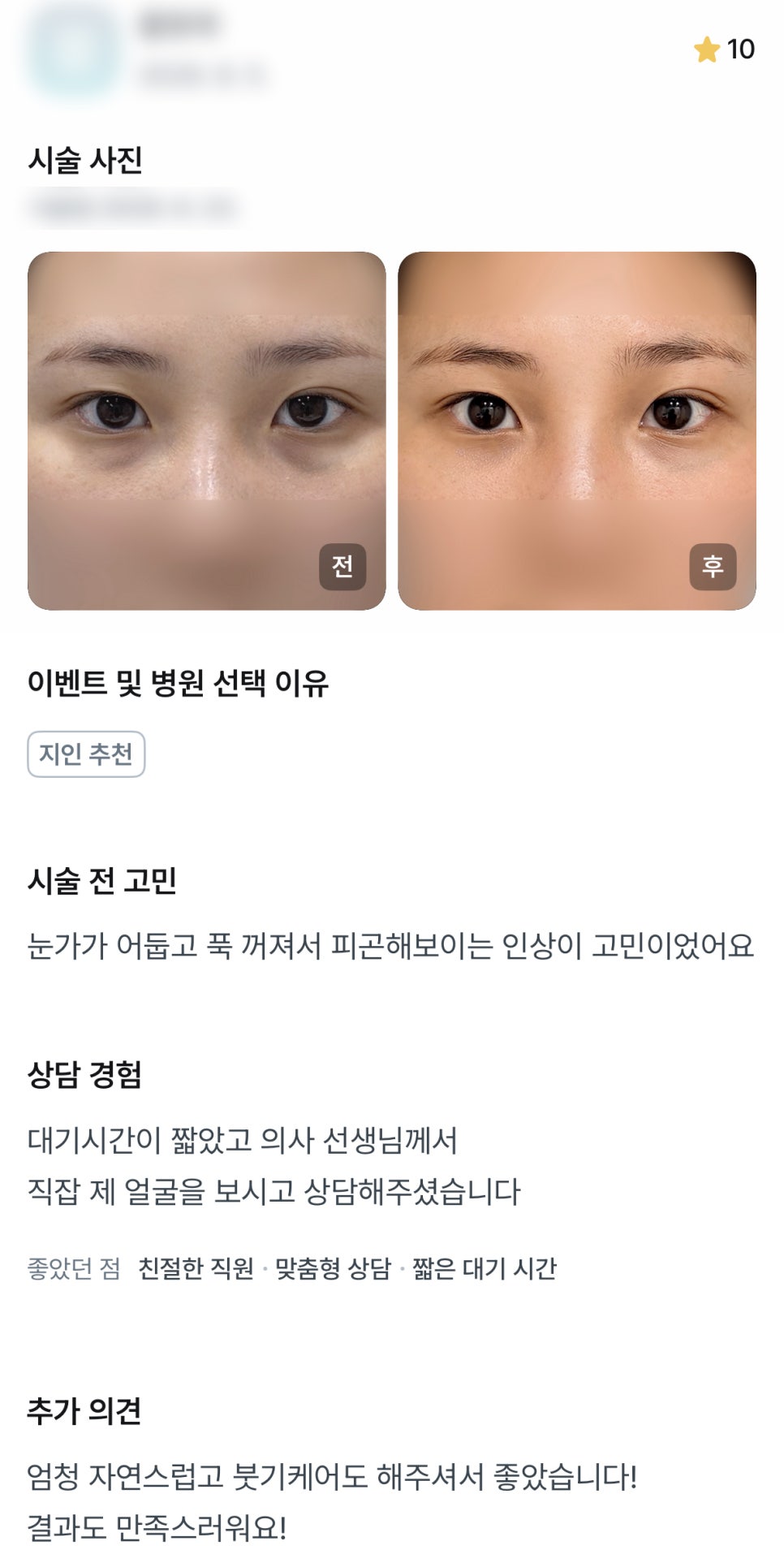 디엠 눈밑지방재배치/눈밑지방이식 수술후기, “엄청 자연스럽고 결과도 만족스러워요!” 관련 이미지 1