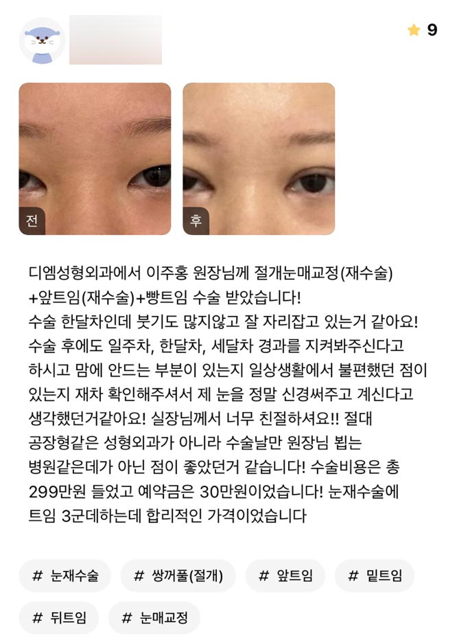눈재수술 후기."제 눈을 정말 신경써주신다는 생각이 들었어요!" 관련 이미지 1