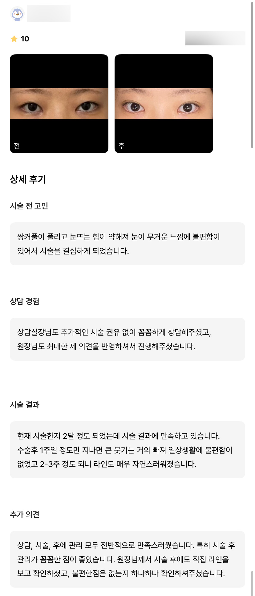 눈재수술 후기."최대한 니즈를 반영해주셨고 자연스러워서 좋아요!" 관련 이미지 1