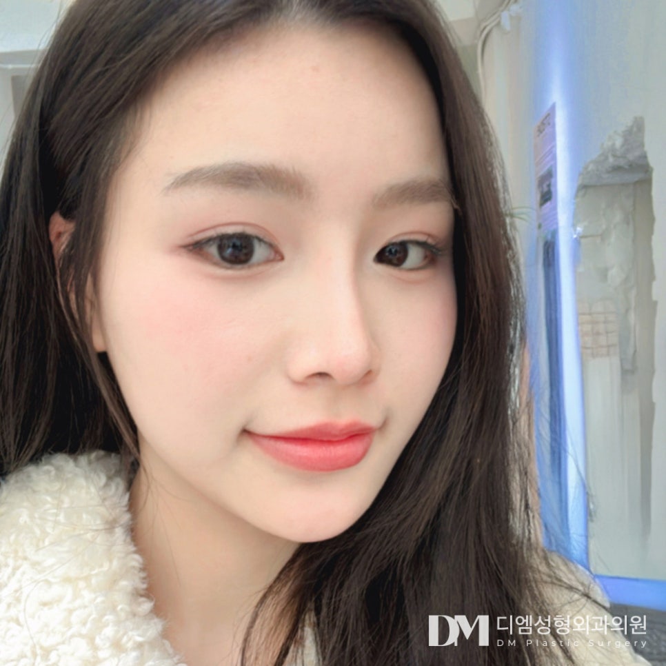 코재수술 , 원인 파악부터 체계적인 플랜까지 ! 관련 이미지 13