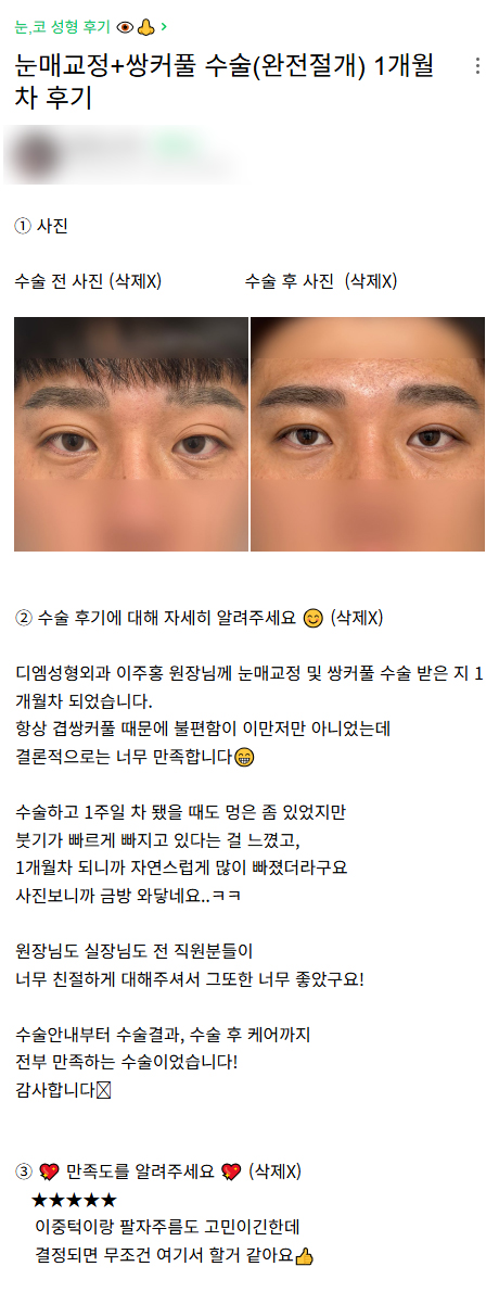 디엠 남자눈성형/남자눈매교정 후기, “수술 결과, 수술 후 케어까지 전부 만족합니다!” 관련 이미지 1