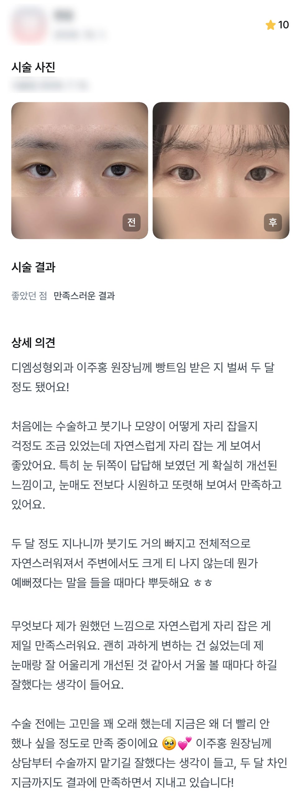 디엠 뒤밑트임/트임성형 후기, &ldquo;거울 볼 때마다 하길 잘했다는 생각이 들어요!&rdquo; 관련 이미지 1