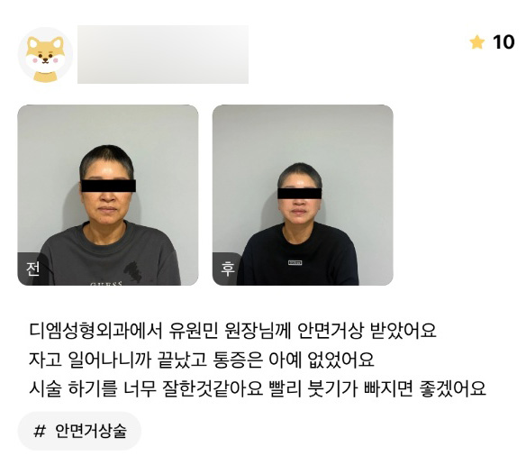 안면거상 후기."통증은 아예 없고 시술 하기를 너무 잘한 것 같아요!" 관련 이미지 1