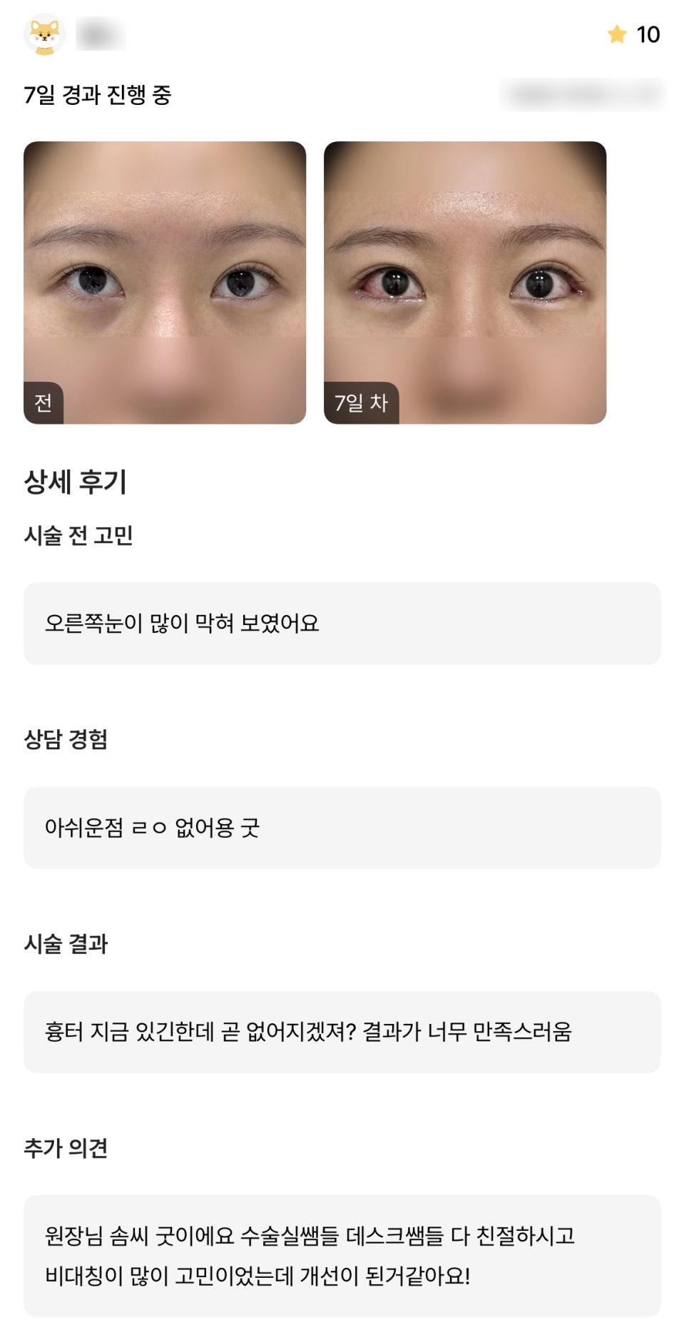 디엠 빵트임 수술후기, “결과가 너무 만족스러워요!” 관련 이미지 1
