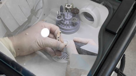 🦷 임플란트 수술 전 과정을 생중계로! &ndash; 예스미르치과 x 덴올TV 관련 이미지 17