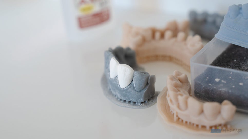 ✨앞니 색상, 자연스럽게? 새하얗게? 고민된다면 - 미라클네이트 관련 이미지 3
