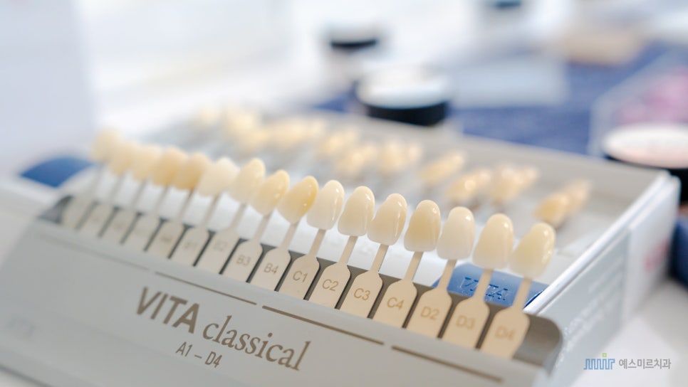 ✨앞니 색상, 자연스럽게? 새하얗게? 고민된다면 - 미라클네이트 관련 이미지 2