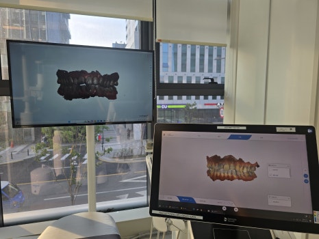 ๐ฆท ์น์์ ๊น๋ง ์ ์ด ๋ณด์ฌ์! - ์๋๋ฏน ์ธ๋ผ๋ฏน ์ธ๋ ์ด ๊ด๋ จ ์ด๋ฏธ์ง 3