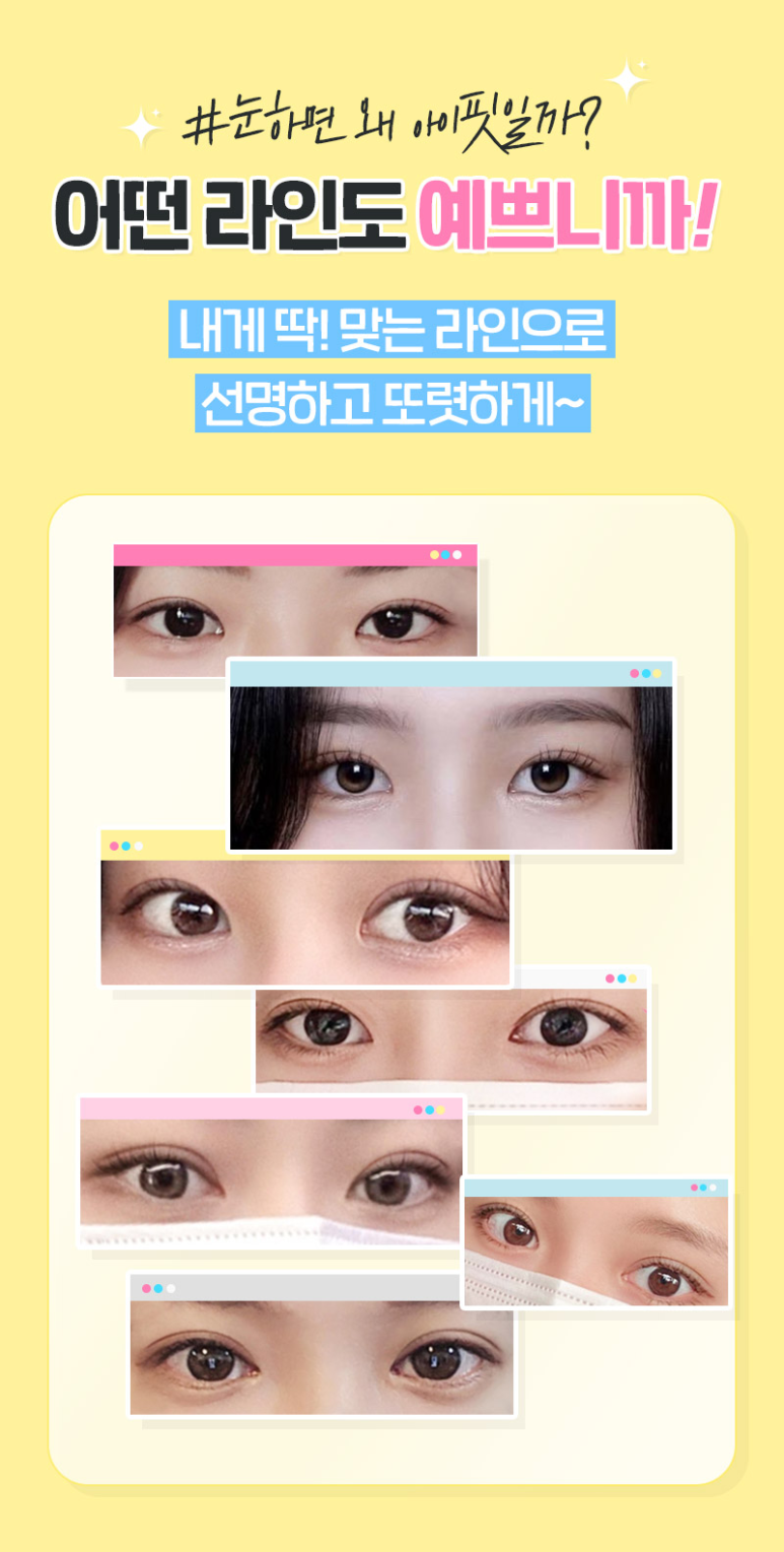 눈 성형하면 왜 아이핏일까? 관련 이미지 1