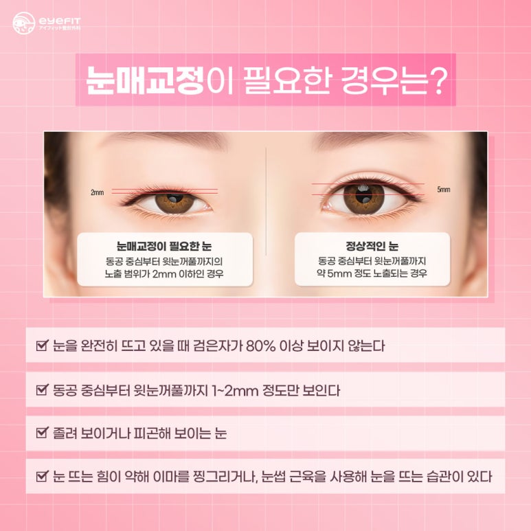 [Eyefit Plastic Surgery] When the eyes lack the strength to open, make them clearer with eye correction image 6