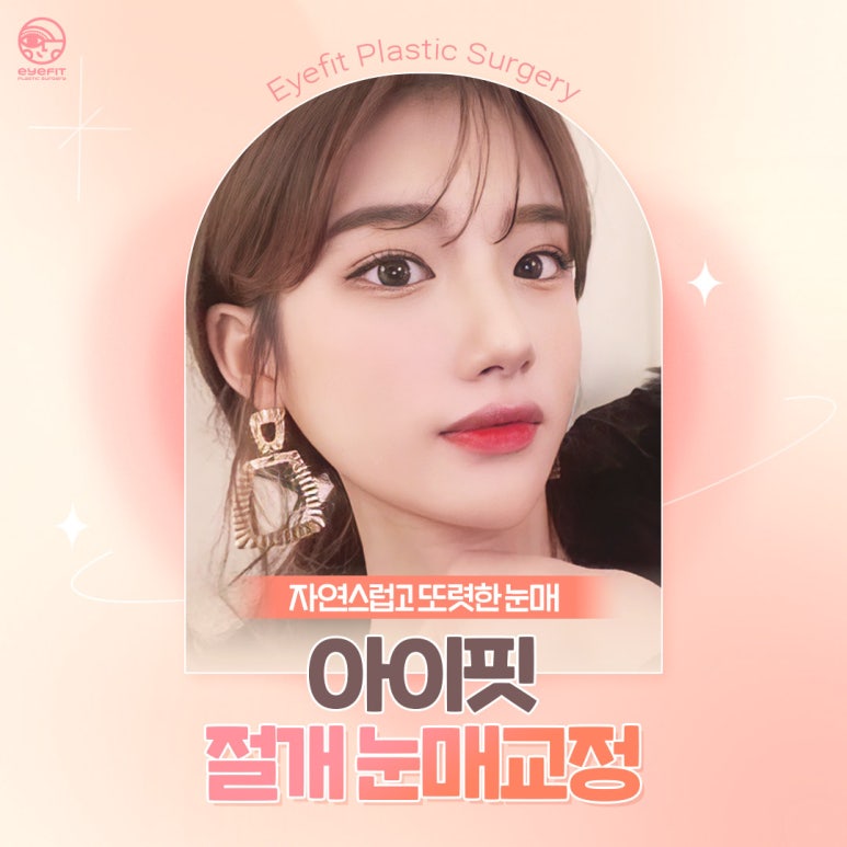 [아이핏성형외과] 절개눈매교정 전후 또렷한 눈매로 관련 이미지 1