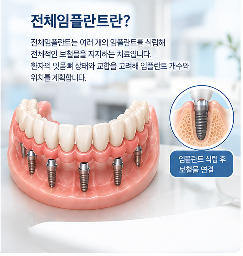 약수역 치과 임플란트와 틀니 차이, 어떤 치료가 나에게 맞을까요? 관련 이미지 2