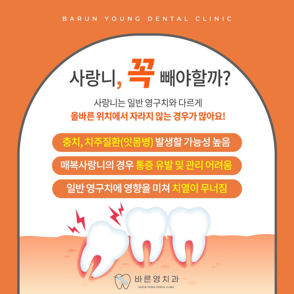 약수역치과 매복사랑니 발치가 중요한 이유 관련 이미지 3