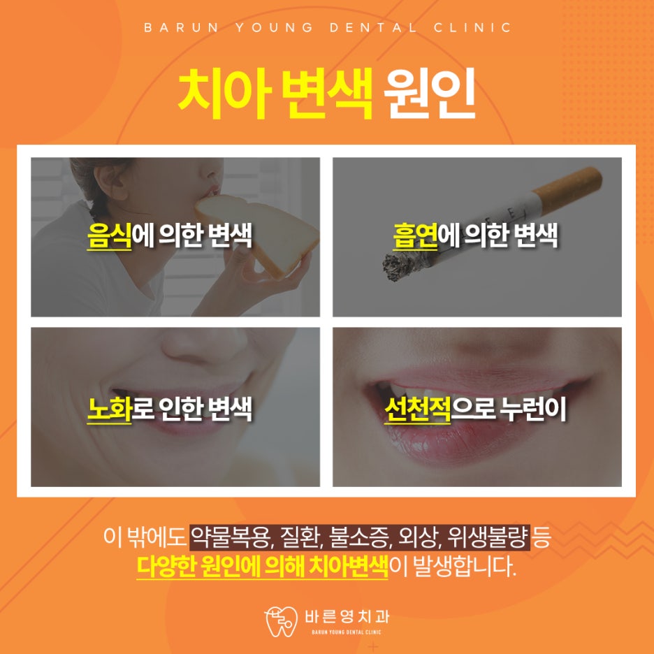 신당역치과 치아미백, 구강건강까지 지킬 수 있어야 관련 이미지 2