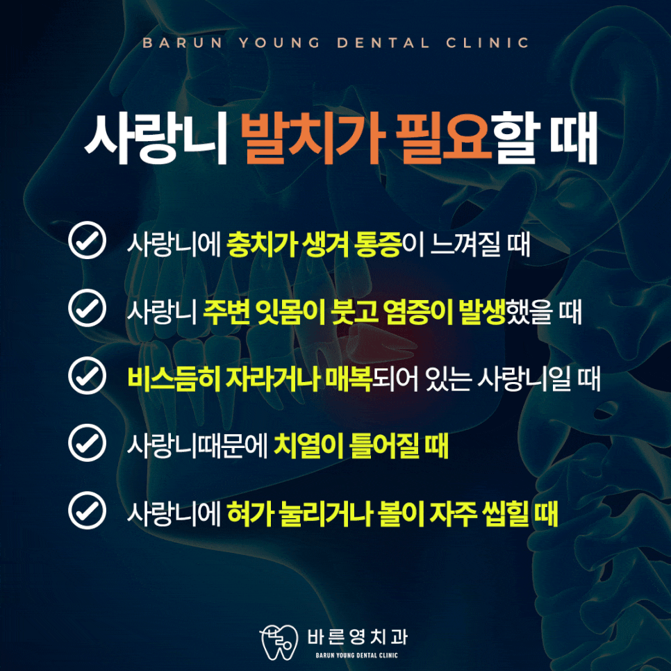 다산동치과, 사랑니 당일 발치 가능한 치과 찾는다면 관련 이미지 3