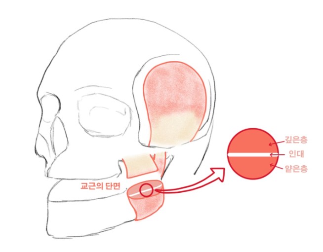 신당동 치과, 턱 보톡스 주사 이후에 나타날 수 있는 증상 ( 사각턱, 저작근, 볼 알사탕 현상) 관련 이미지 4