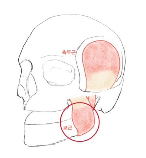 신당동 치과, 턱 보톡스 주사 이후에 나타날 수 있는 증상 ( 사각턱, 저작근, 볼 알사탕 현상) 관련 이미지 1
