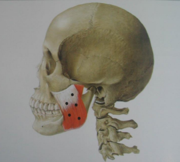 약수역치과, 턱관절 관련 질환(보톡스 치료) 관련 이미지 4