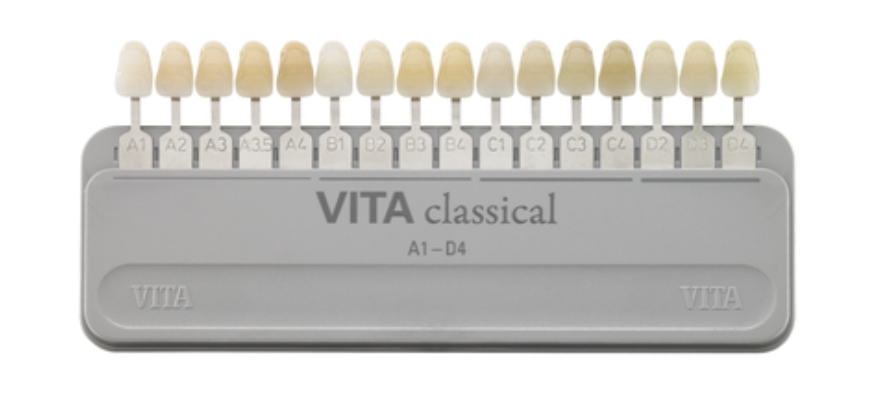 약수역 치과, 치아 미백 1회 방문으로 효과가 있을까?(feat. 원데이 미백) 관련 이미지 4