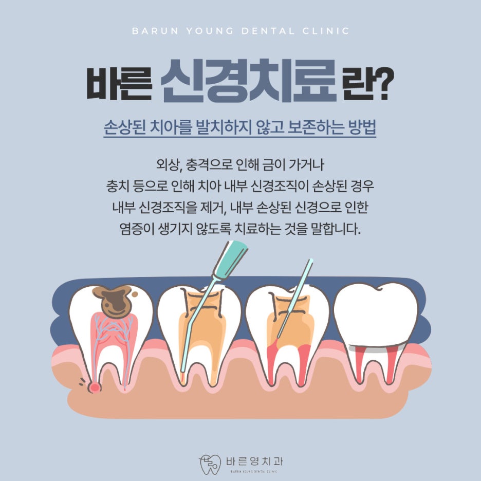 신당역치과 충치치료 자연치아 살리려는 것을 우선으로 관련 이미지 8