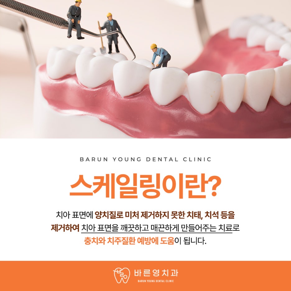 약수역치과, 치아 상실할 수도 있는 잇몸질환 예방하려면 관련 이미지 12