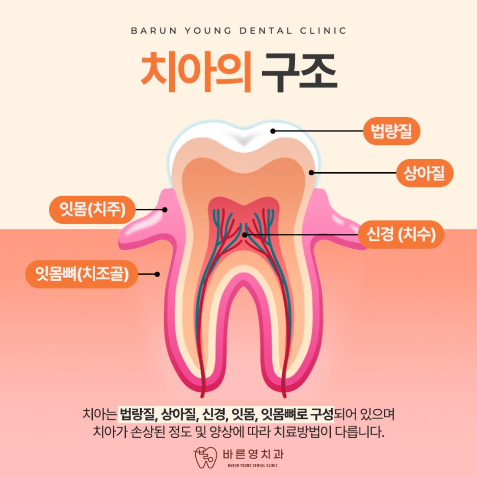 금호동치과, 잇몸 피나고 시린 치주질환 스케일링으로 예방해요 관련 이미지 1