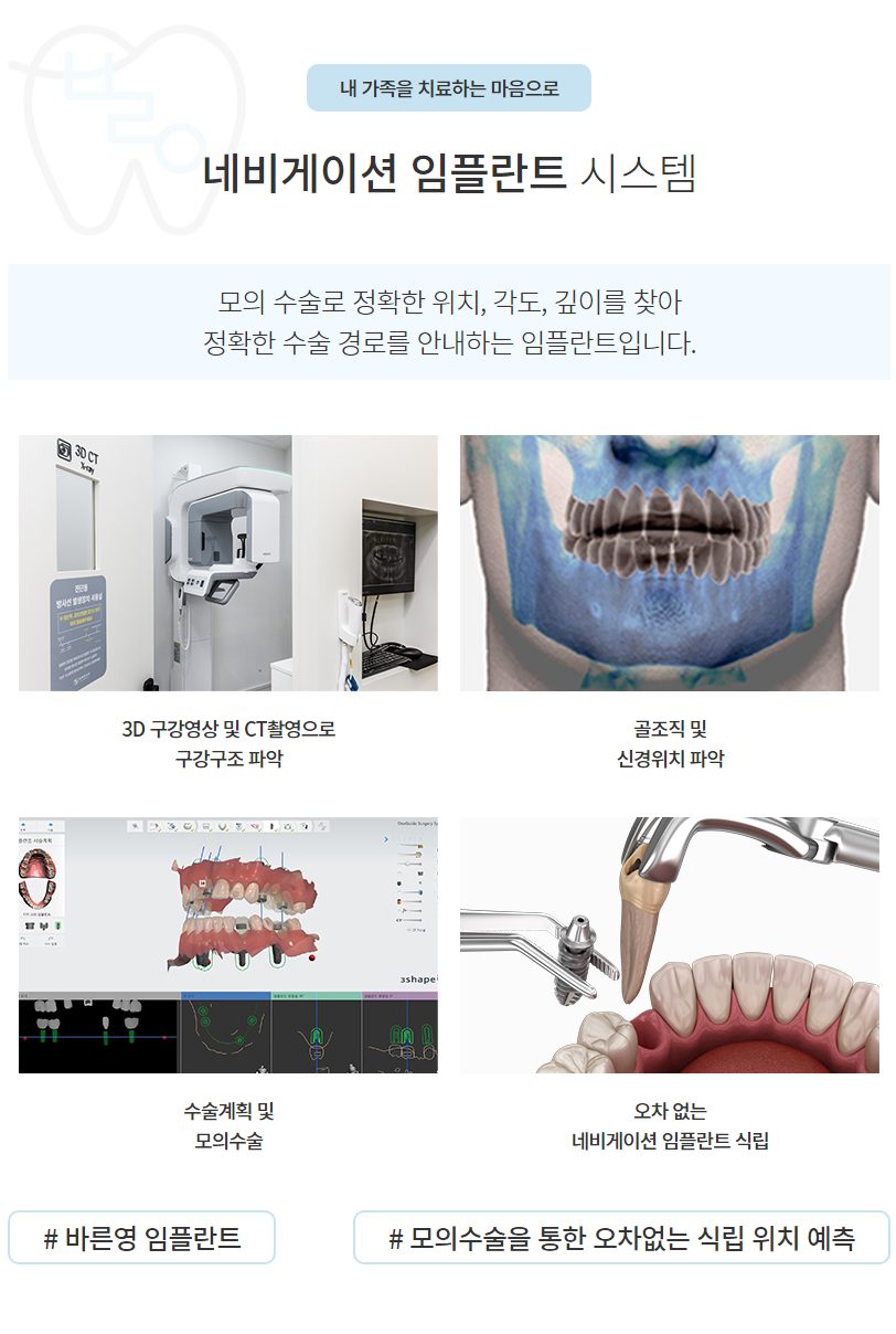 신당역치과 잃어버린 치아 네비게이션 임플란트로 되찾으세요 관련 이미지 6
