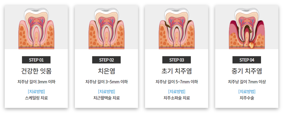약수역치과, 양치할 때 피 난다면 잇몸염증치료 필요해요 관련 이미지 10