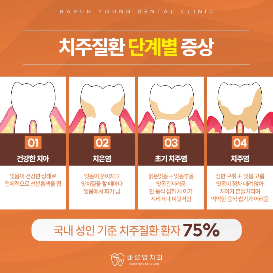 신당역치과 치은염 치주염 치아 잃기 전에 조기예방하려면 관련 이미지 9