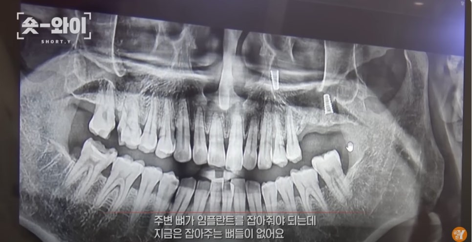 중구 약수역 김태영 원장 SBS 관련 이미지 6