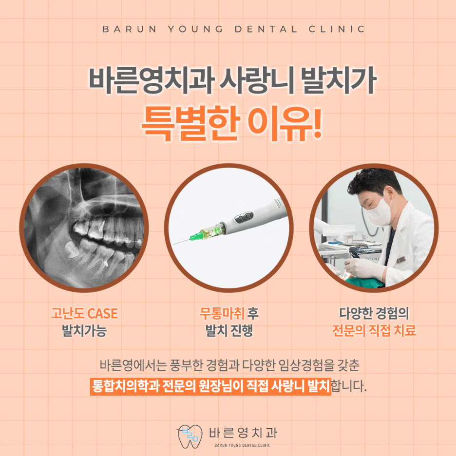 약수역치과 매복사랑니 발치가 중요한 이유 관련 이미지 6