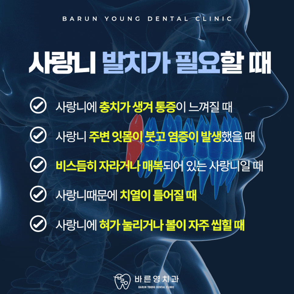 다산동치과 사랑니 당일발치 원한다면 관련 이미지 6
