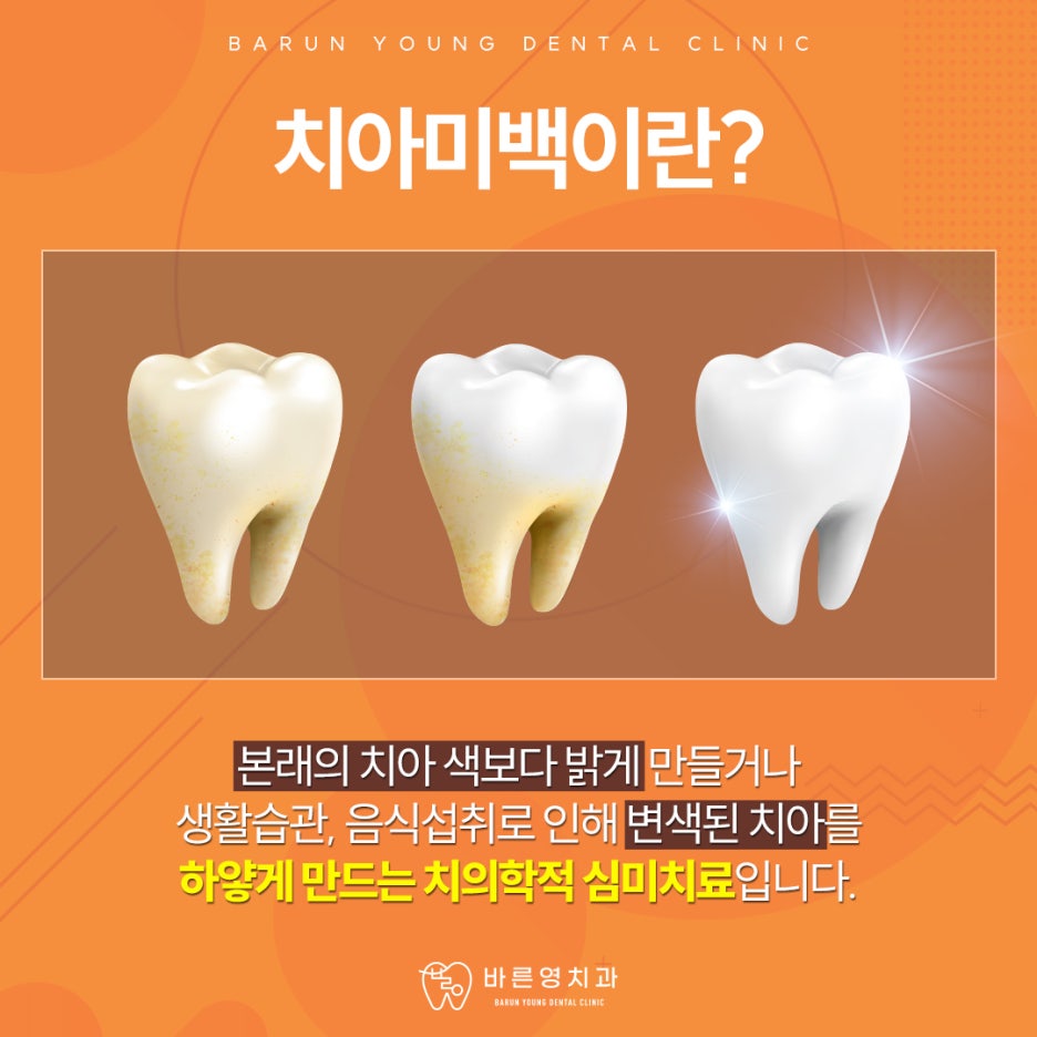 신당역치과 치아미백, 구강건강까지 지킬 수 있어야 관련 이미지 1