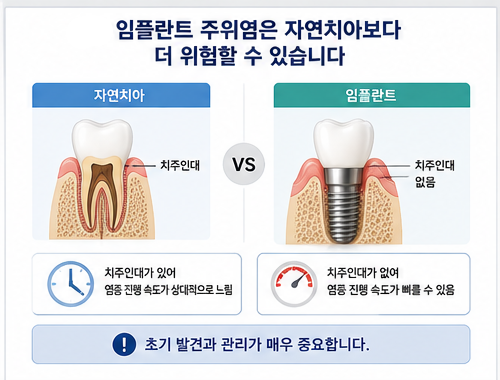 Yaksu Station Dental Clinic: Can Gum Disease Develop Around Implants, Too? image 3